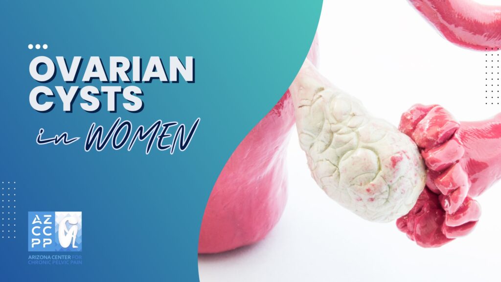 Pelvic Pain Treatment for women - Ovarian Cysts in Women