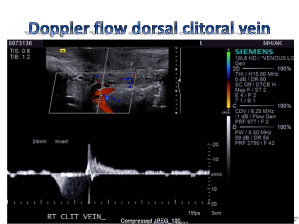 Clitorus in stabbing pain Vulvar Pain