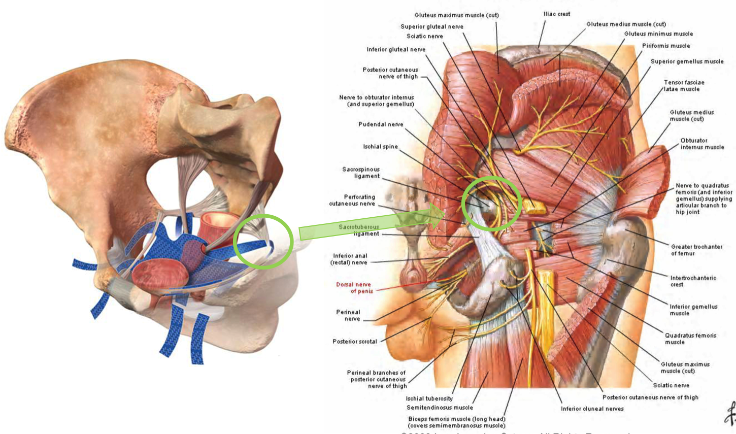 Pudendal and Other Nerve Damage - Posterior Femoral Cutaneous, Ileoinguinal  and Obturator in the Transvaginal Mesh Patient