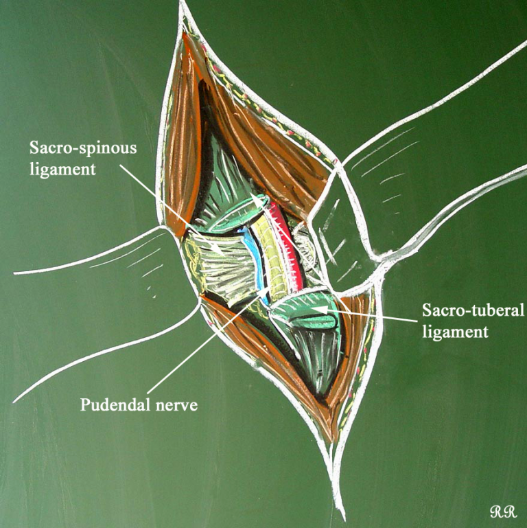 pudendal-neuralgia-1-proven-pelvic-pain-surgeon