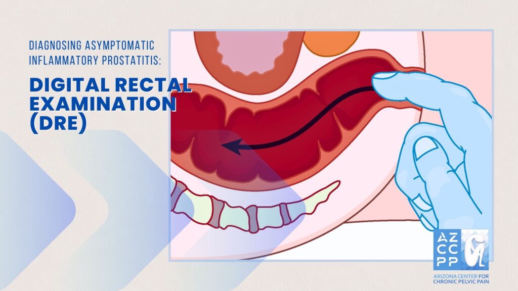 Diagnosing Asymptomatic Inflammatory Prostatitis_Digital Rectal Examination_DRE_AZCCPP, Chronic Pelvic Pain Treatment, Michael Hibner