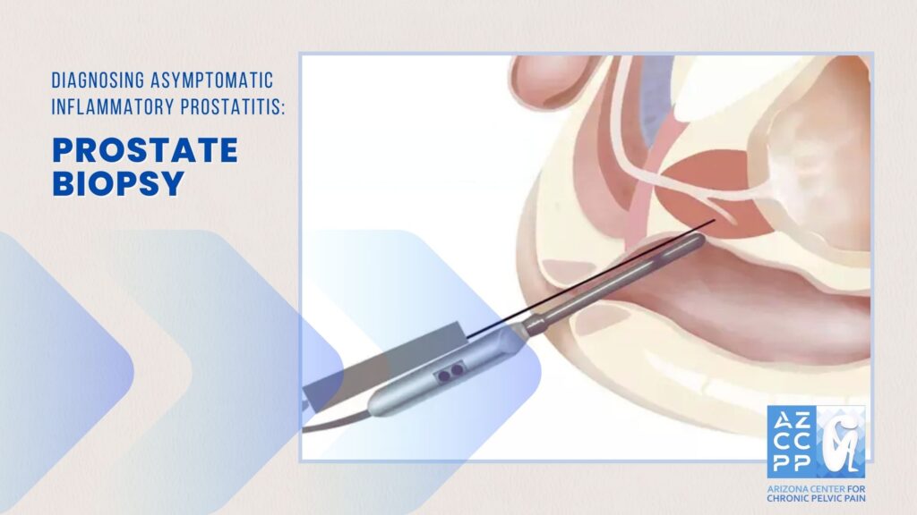 Diagnosing Asymptomatic Inflammatory Prostatitis, Prostate Biopsy, AZCCPP, Chronic Pelvic Pain Treatment, Michael Hibner