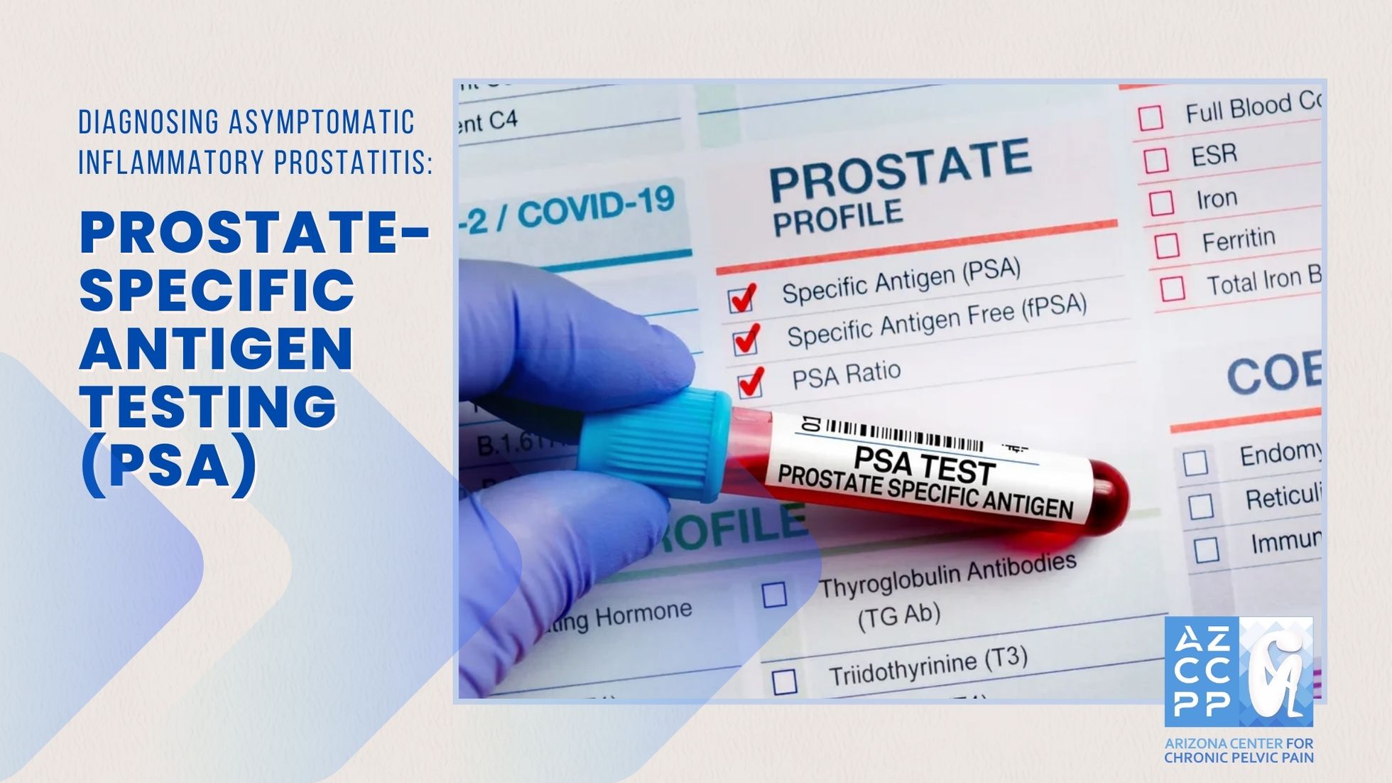 Diagnosing Asymptomatic Inflammatory Prostatitis_Prostate-Specific Antigen Testing_PSA Testing_AZCCPP, Chronic Pelvic Pain Treatment, Michael Hibner