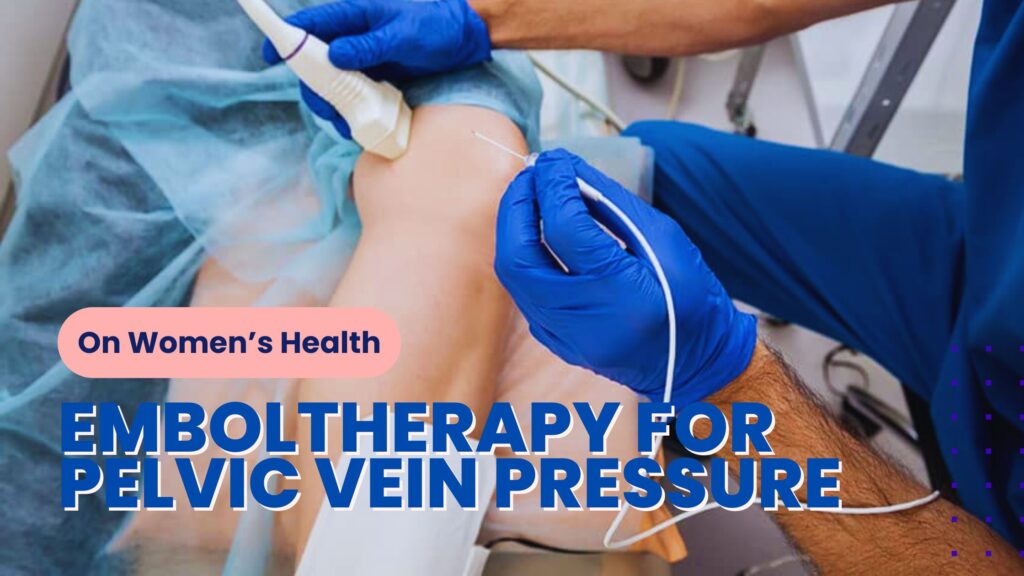 Emboltherapy - Pelvic Vein Embolization - Pelvic Vein Pressure