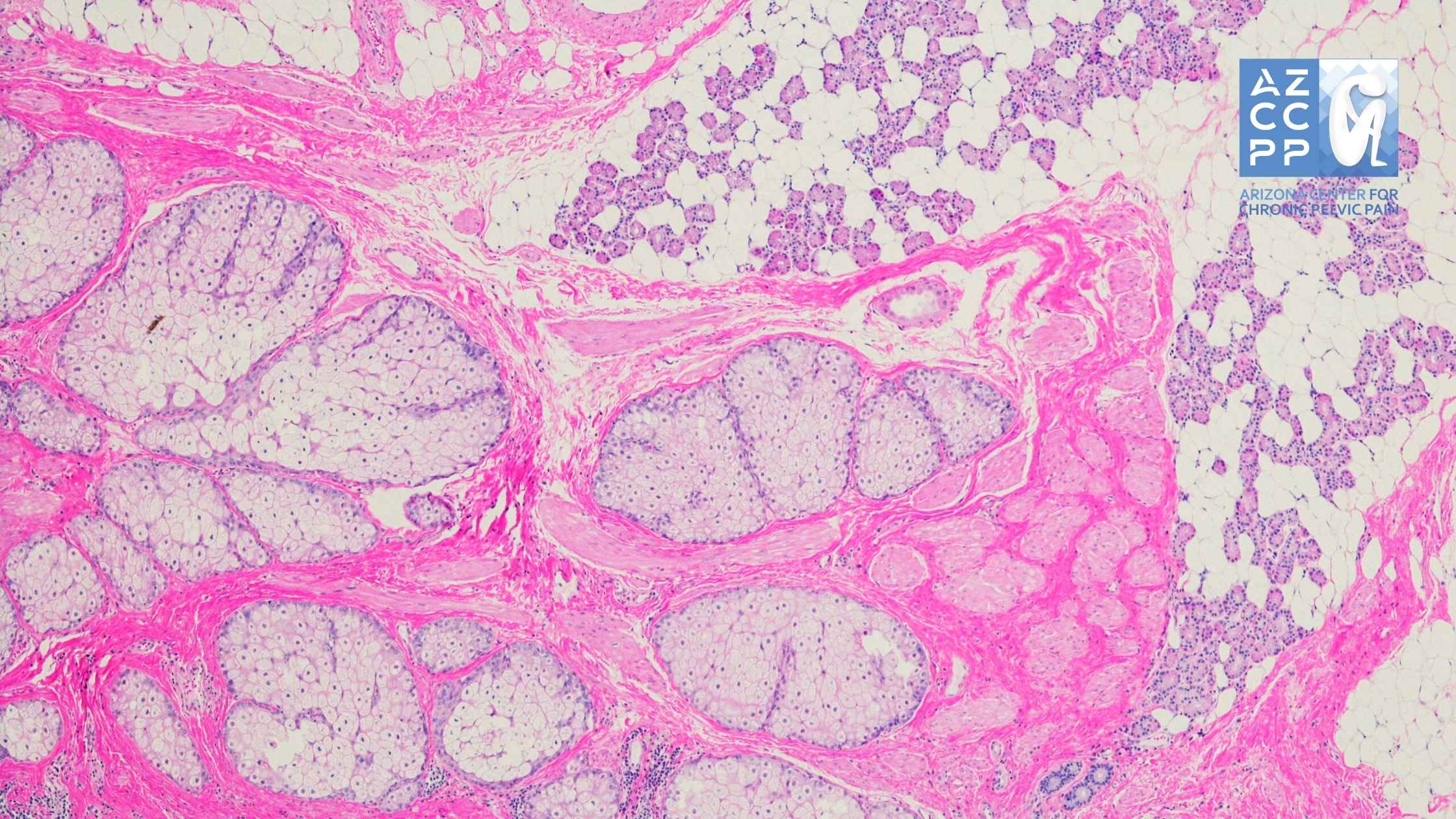 On Women’s Health - Ovarian Cysts Crucial Facts on Symptoms, Treatment, & More - When to Seek Medical Attention 