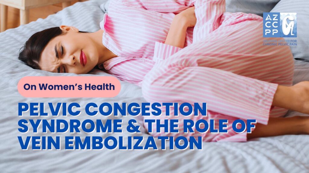 On Women’s Health - Understanding Pelvic Congestion Syndrome and the Role of Vein Embolization