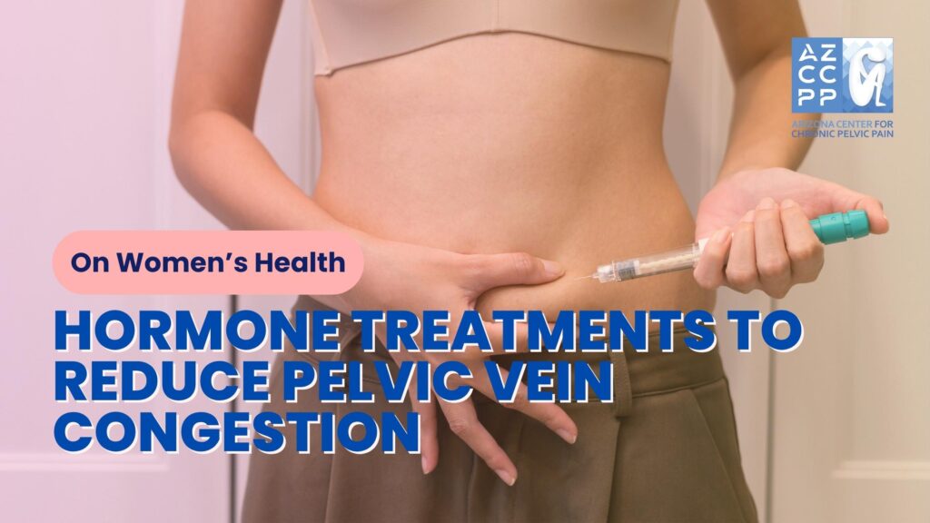On Women’s Health - Hormone Treatments to Reduce Pelvic Vein Congestion A Comprehensive Guide